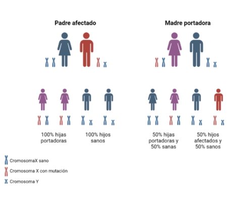 EL SÍNDROME DEL CROMOSOMA X FRÁGIL: LA PRINCIPAL CAUSA HEREDITARIA DE DISCAPACIDAD INTELECTUAL