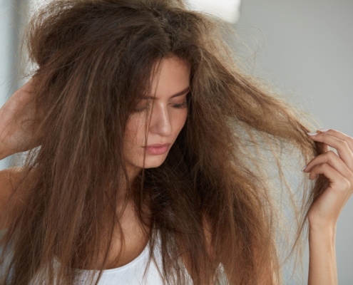 EL SÍNDROME DE PELO IMPEINABLE: UN RARO FENÓMENO GENÉTICO